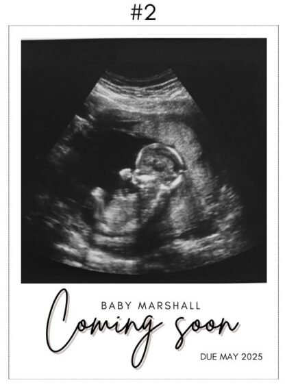 Pregnancy Announcement! - Custom Magnet Polaroid Style - Image 6